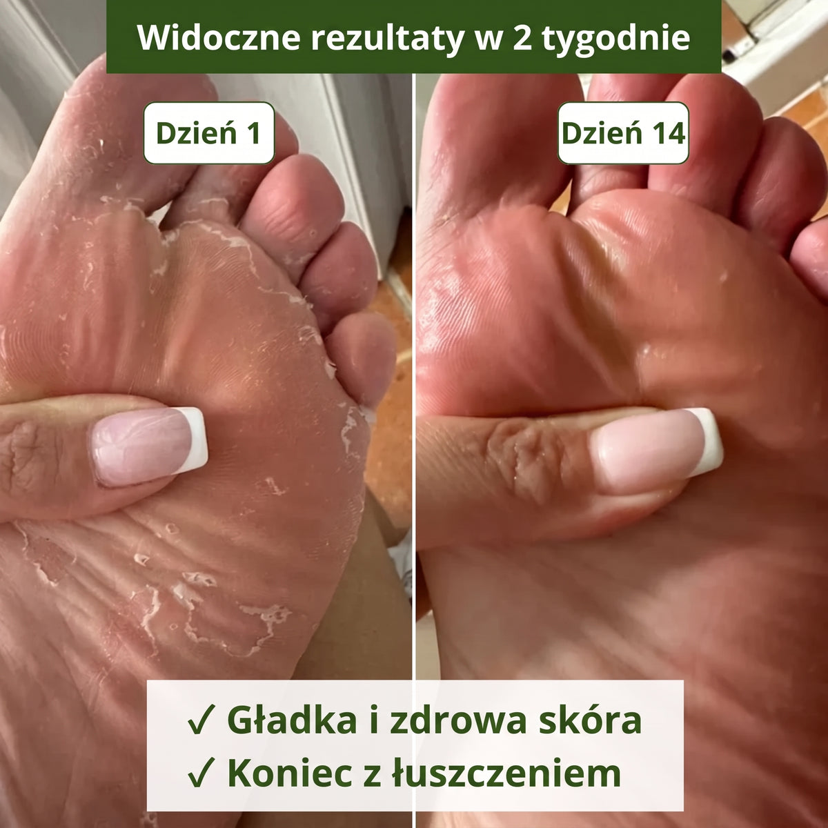Mydło przeciwgrzybicze Winorandi